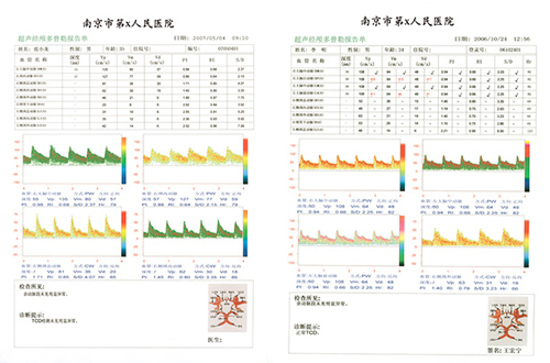 TCD檢測報(bào)告